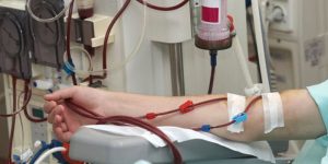 hémodialyse